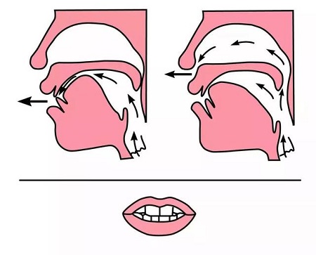 小孩口齿不清可能和舌系带长短有关